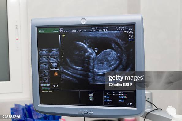 88 3 Months Pregnant Ultrasound Photos and Premium High Res Pictures - Getty Images 88 3 Months Pregnant Ultrasound Photos and Premium High Res Pictures - Getty Images