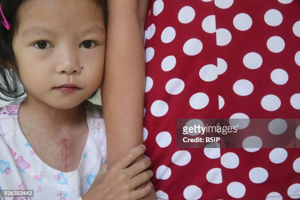 The Heart Institute offer high-quality care to Vietnamese patients suffering from heart diseases. Girl with mother. Ho Chi Minh City. Vietnam.