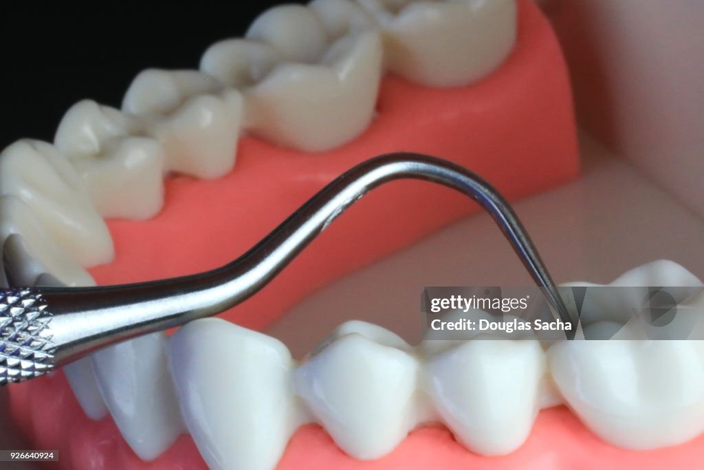 Dental Probe tool examines the human teeth