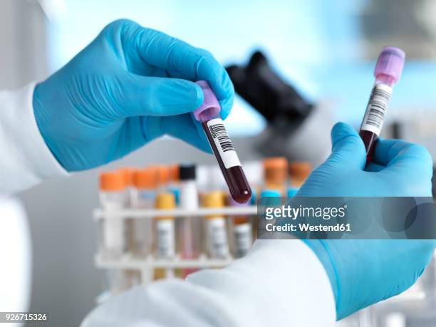 hand holding blood sample in laboratory - medizinischer test stock-fotos und bilder