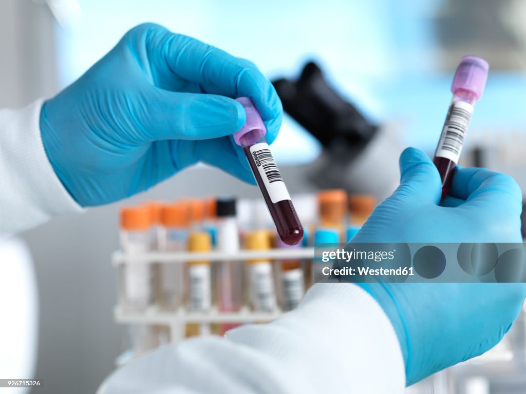 Hand holding blood sample in laboratory