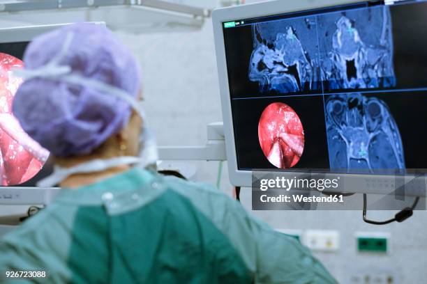 neurosurgeon in scrubs looking at monitor - neurosurgery stock pictures, royalty-free photos & images