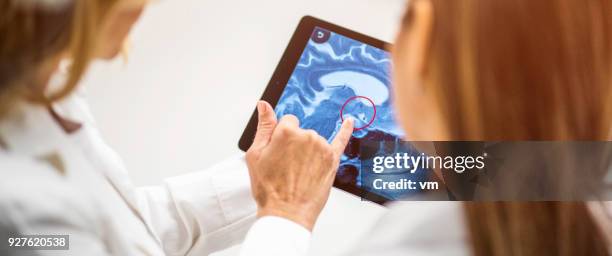 gros plan de l’anatomie du cerveau sur tablette numérique - cancer du cerveau photos et images de collection