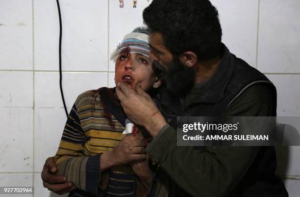 Wounded Syrian child is comforted by a man following a reported air strike by Syrian government forces in Kafr Batna, in the Syrian rebel enclave of...