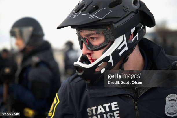 Police officer is bloodied after a clash with demonstrators before the start of a speech by white nationalist Richard Spencer, who popularized the...