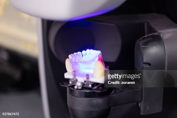 scanning of denture model - medical scanning equipment stock pictures, royalty-free photos & images