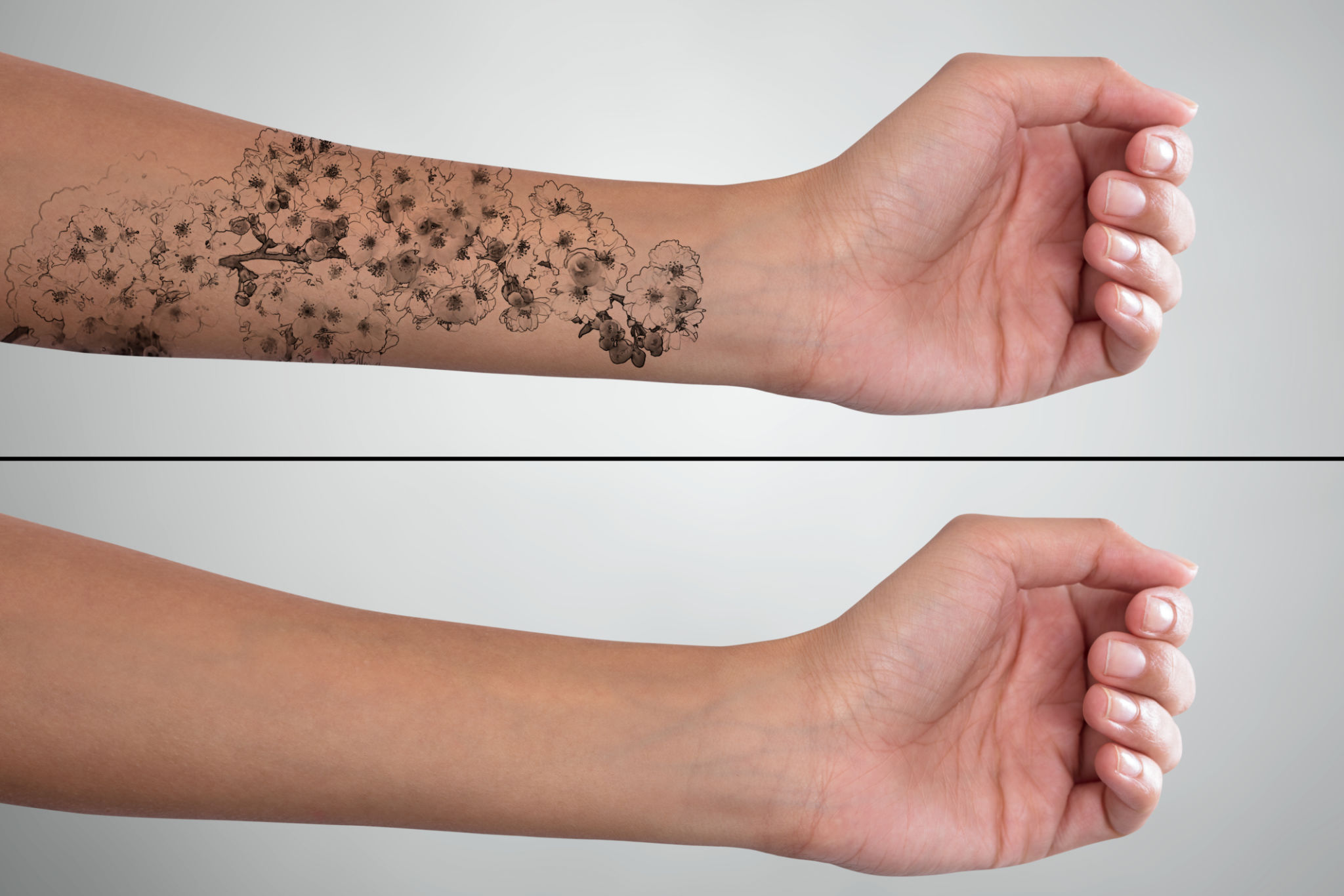mejorar tatuaje