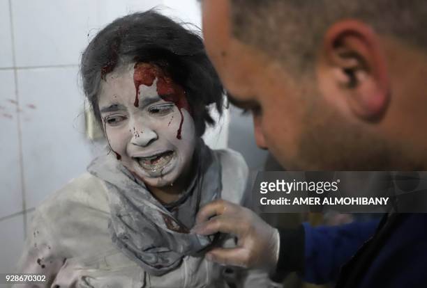 Graphic content / TOPSHOT - A Syrian girl receives treatment as victims of reported regime air strikes on Hamouria, Saqba and Kafr Batna are brought...