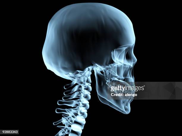 x-ray - skull xray no brain stock pictures, royalty-free photos & images