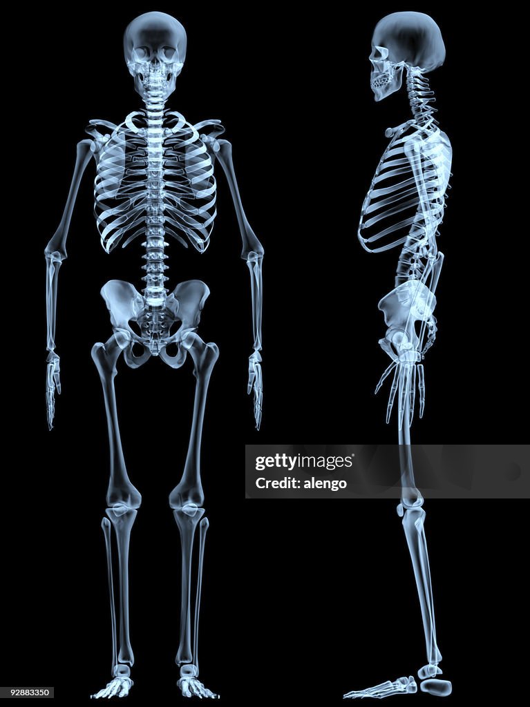 Radiografía esqueleto