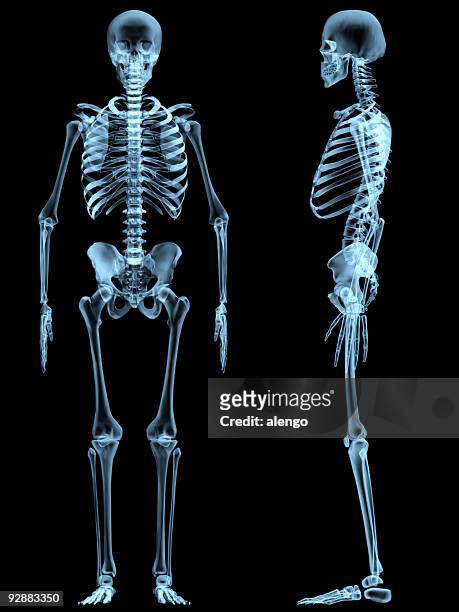 x-ray skeleton - röntgen stockfoto's en -beelden