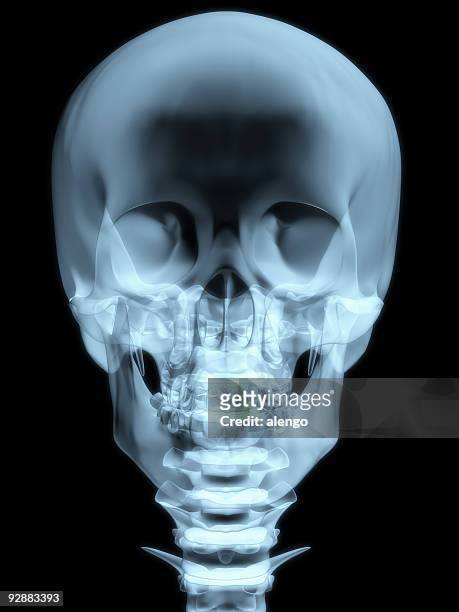 x-ray - skull xray no brain stock pictures, royalty-free photos & images