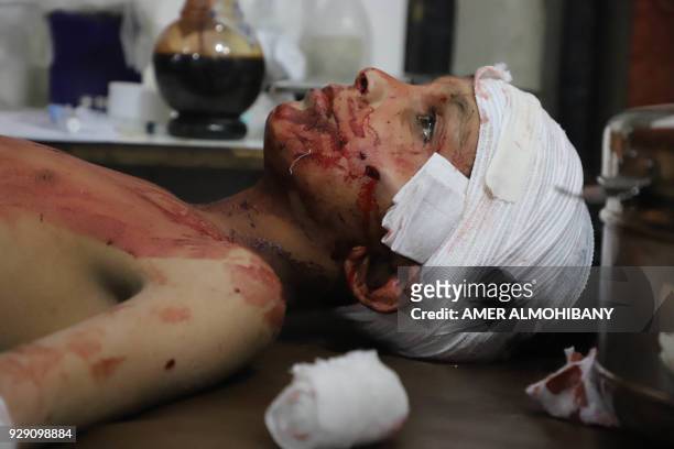 Graphic content / TOPSHOT - A Syrian boy receives treatment as victims of reported regime air strikes on Hamouria, Saqba and Kafr Batna are brought...