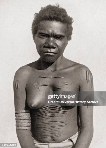 Cicatrization or scarification. The custom of making scars on the body. In this case the subject is an Australian Aboriginal woman. Scars are often...