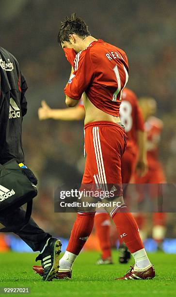 Albert Riera of Liverpool walks off because he got injured during the match between LiverpooL FC and Birmingham City at Anfield on 9th November, 2009...