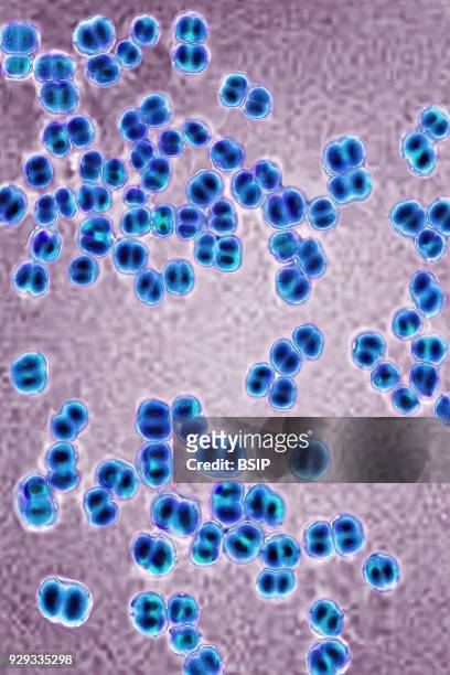 Meningococci, Neisseria Meningitidis, the bacteria in meningitis. Seen under optical microscopy X 1000.