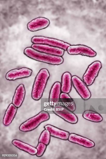 Pseudomonas, Pseudomonas aeruginosa, Highly-resistant pathogenic bacterium often the cause of hospital-acquired infections. Seen under optical...