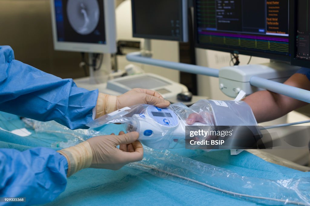 Radiofrequency Ablation