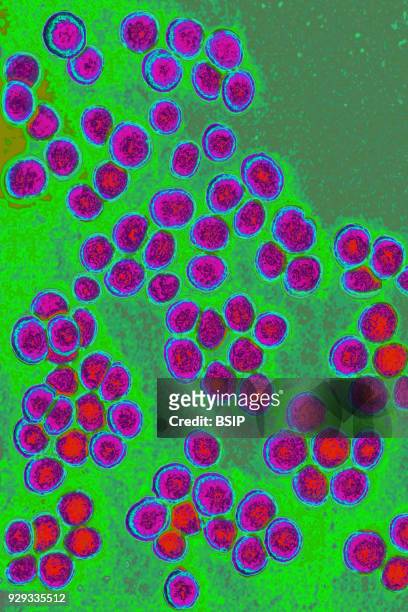 Staphylococcus aureus. Bacteria responsible for food poisoning, localized suppurative infections and some cases of septicemia. Seen under optical...