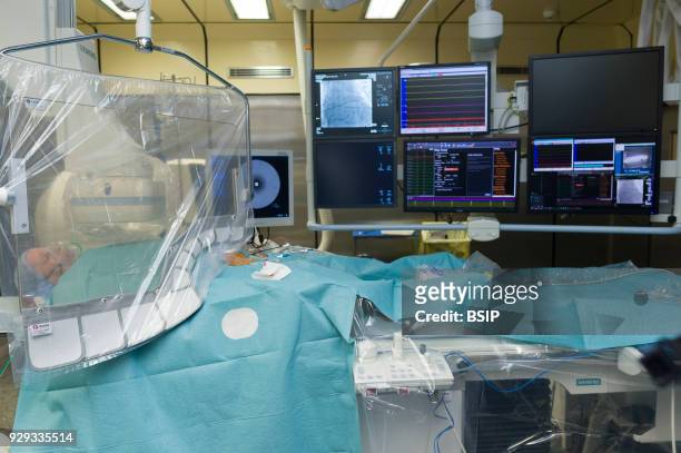 Radiofrequency ablation of cardiac arrhythmia using the Stereotaxis robotic system, by inserting a catheter into the heart, emitting radio waves that...