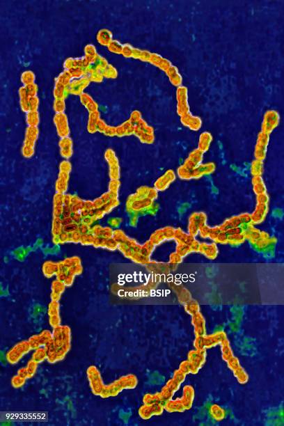 Streptococcus pyogenes A. Bacteria responsible for skin infections, impetigo, abscesses and bronchial-pulmonary infections. Seen under optical...