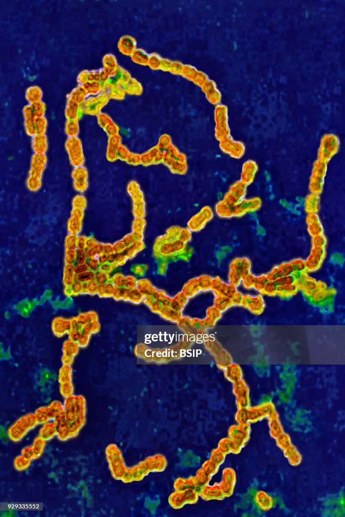 Strep. Pyogenes Pyoderma Streptococcus pyogenes A. Bacteria responsible for skin infections ...