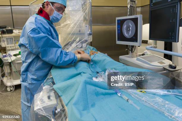 Radiofrequency ablation of cardiac arrhythmia using the Stereotaxis robotic system, by inserting a catheter into the heart, emitting radio waves that...