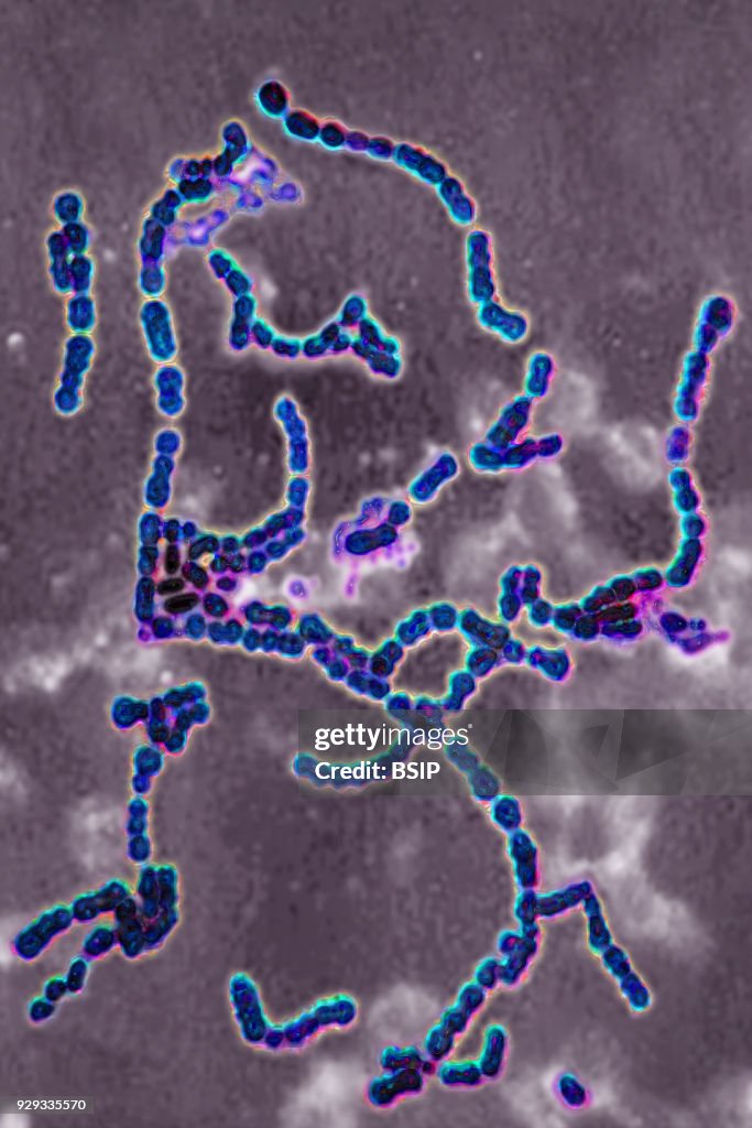 Strept Pyoderma Streptococcus pyogenes A. Bacteria responsible for skin infections ...