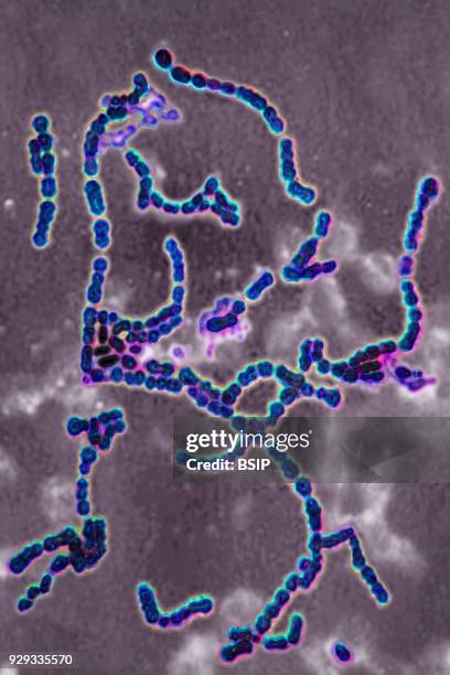 Streptococcus pyogenes A. Bacteria responsible for skin infections, impetigo, abscesses and bronchial-pulmonary infections. Seen under optical...