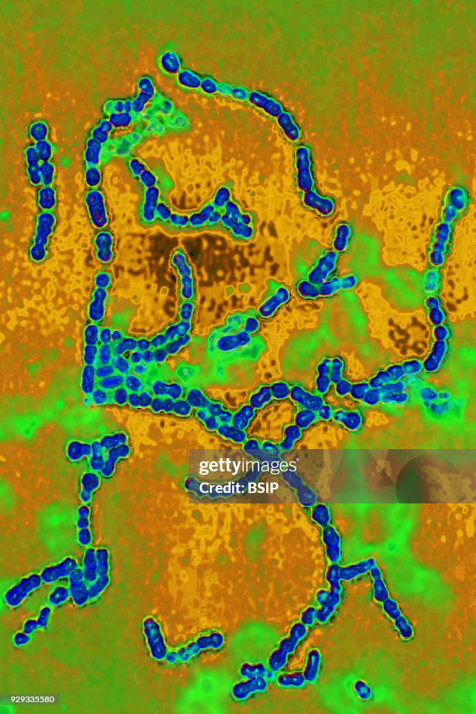 Streptococcus Pyogenes