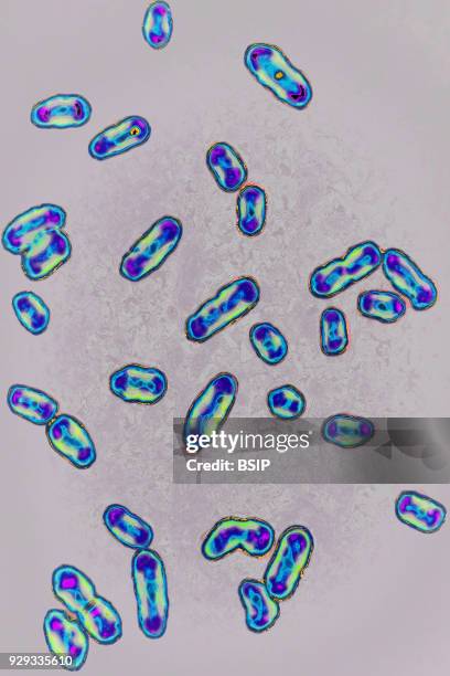 Yersinia pestis, formerly pasteurella pestis, Bacteria responsible for the plague. Seen under optical microscopy X 1000.