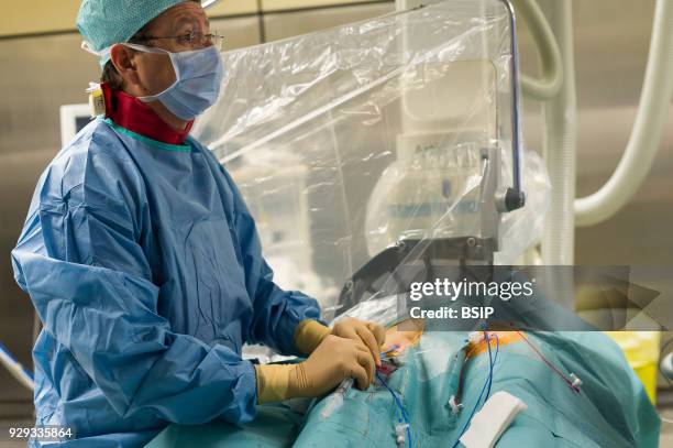 Radiofrequency ablation of cardiac arrhythmia using the Stereotaxis robotic system, by inserting a catheter into the heart, emitting radio waves that...