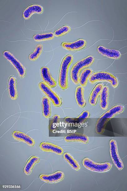 Vibrio cholerae bacterium responsible for cholera. Image produced using optical microscopy X 2000.