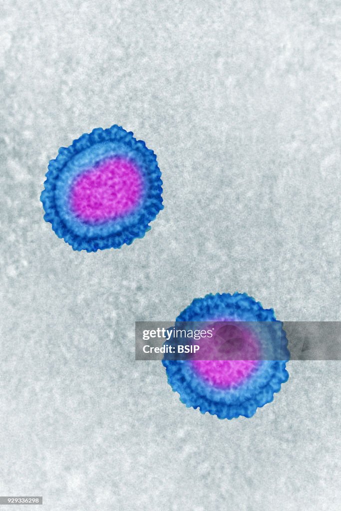Influenza Virus, Tem