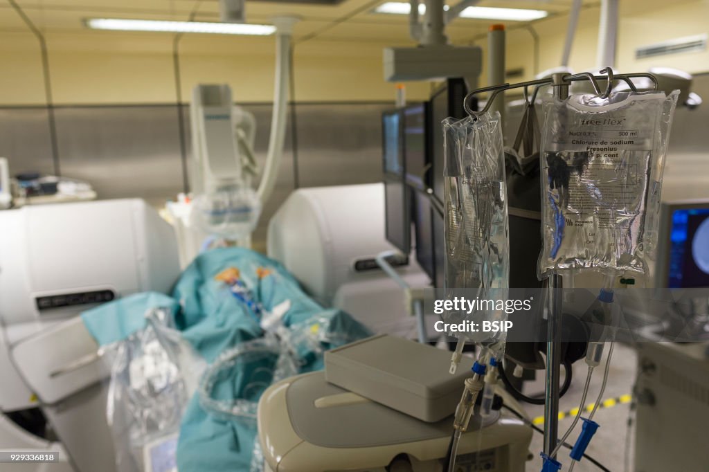 Radiofrequency Ablation