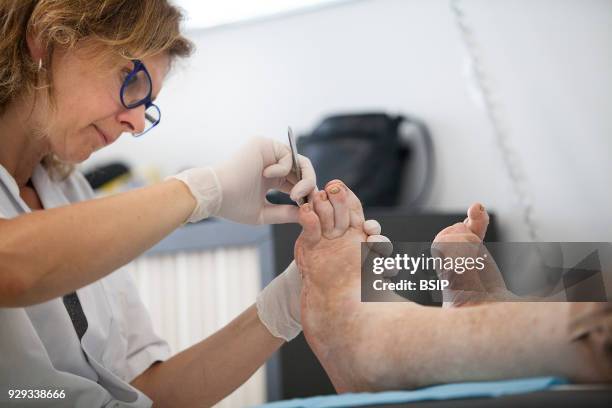 Diabetic feet consultations, Savoie, France, specialized team devoted to treatment and after-care for diabetic patients foot lesions. The chiropodist...