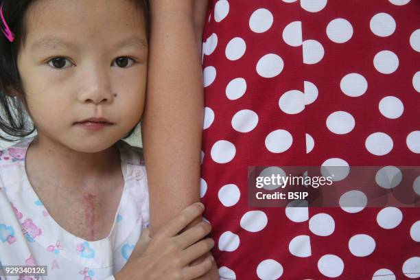 The Heart Institute offer high-quality care to Vietnamese patients suffering from heart diseases. Girl with mother. Ho Chi Minh City. Vietnam.