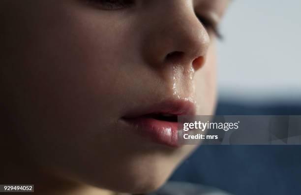 child with a runny nose - snuit stockfoto's en -beelden