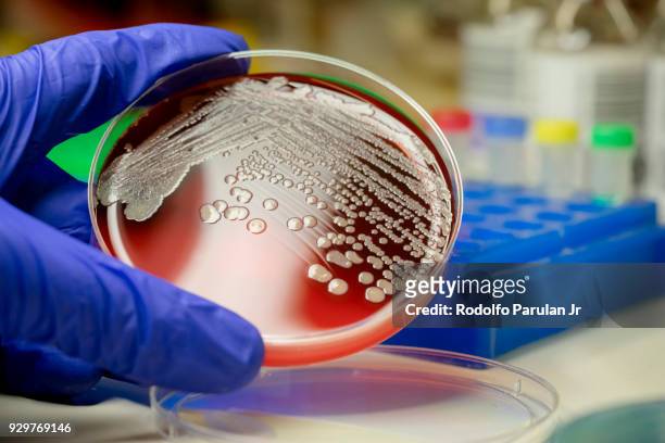 mrsa on blood agar plate - mrsa stock pictures, royalty-free photos & images