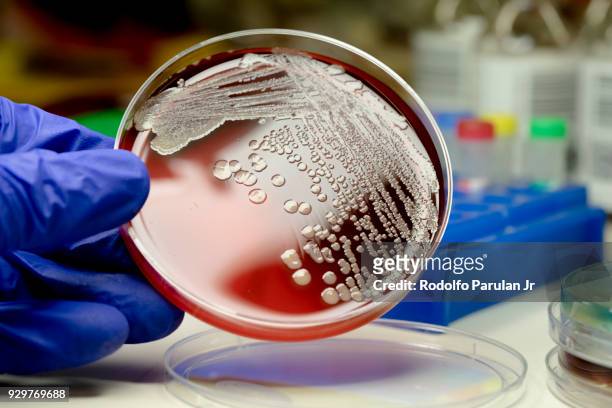 mrsa on blood agar plate - メチシリン耐性黄色ブドウ球菌 ストックフォトと画像