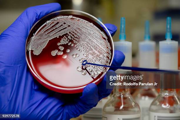 mrsa on blood agar plate - メチシリン耐性黄色ブドウ球菌 ストックフォトと画像