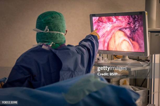 Gynecology surgery, Chambery Metropole Savoie Hospital, France, Conservative hysterectomy by vaginal laparoscopy in a 44-year old patient suffering...