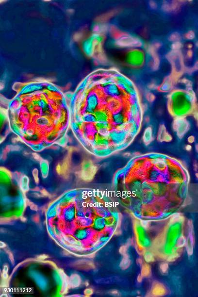 The measles virus, paramyxoviridae from the Morbillivirus family, transmission microscopy view.