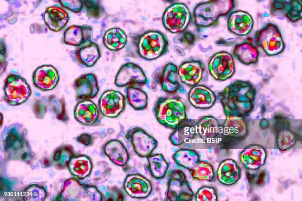 The measles virus, paramyxoviridae from the Morbillivirus family, transmission microscopy view.