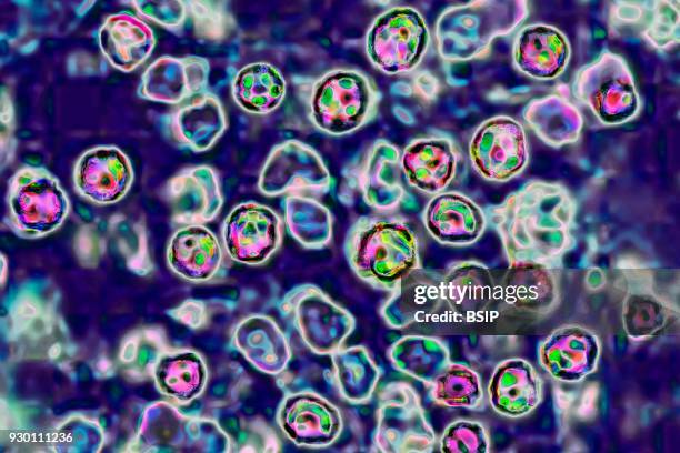 The measles virus, paramyxoviridae from the Morbillivirus family, transmission microscopy view.