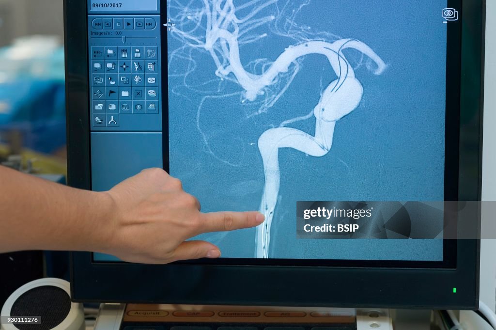 Interventional Neuroradiology