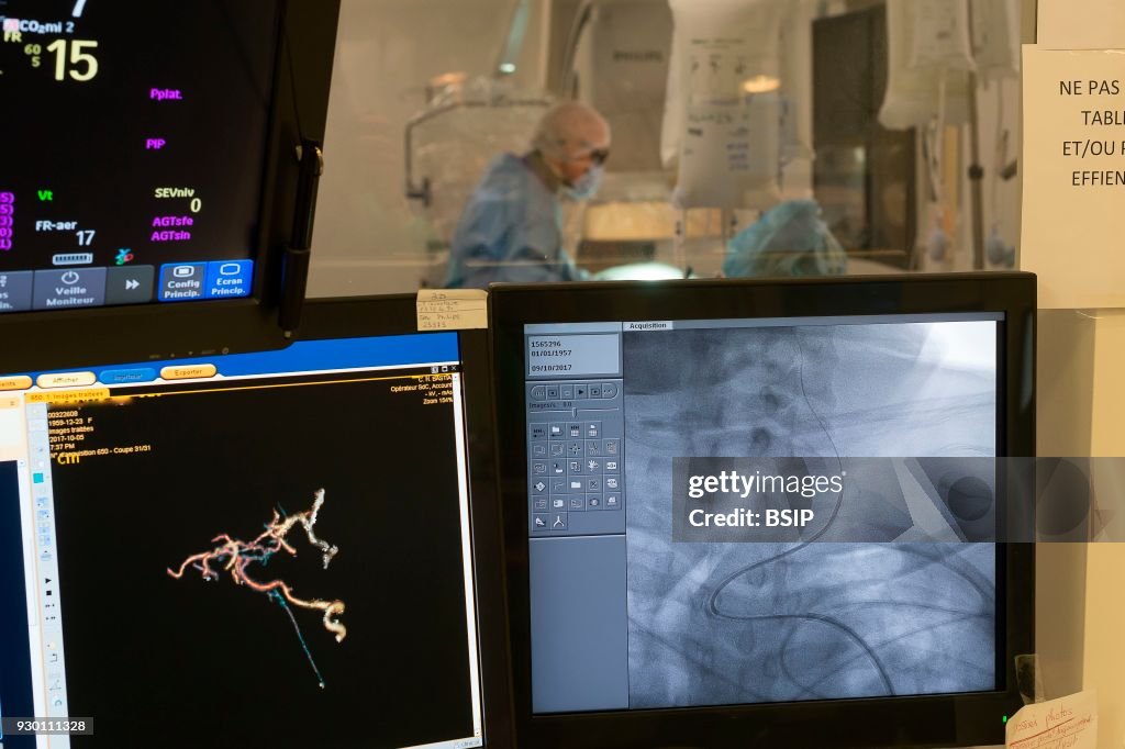 Interventional Neuroradiology