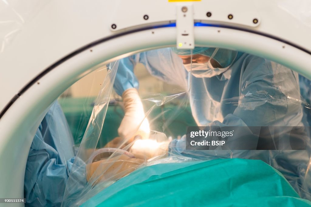 Spine Surgery