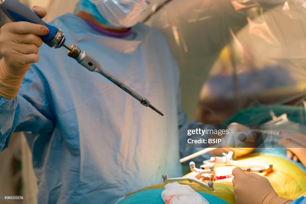 Spine Surgery