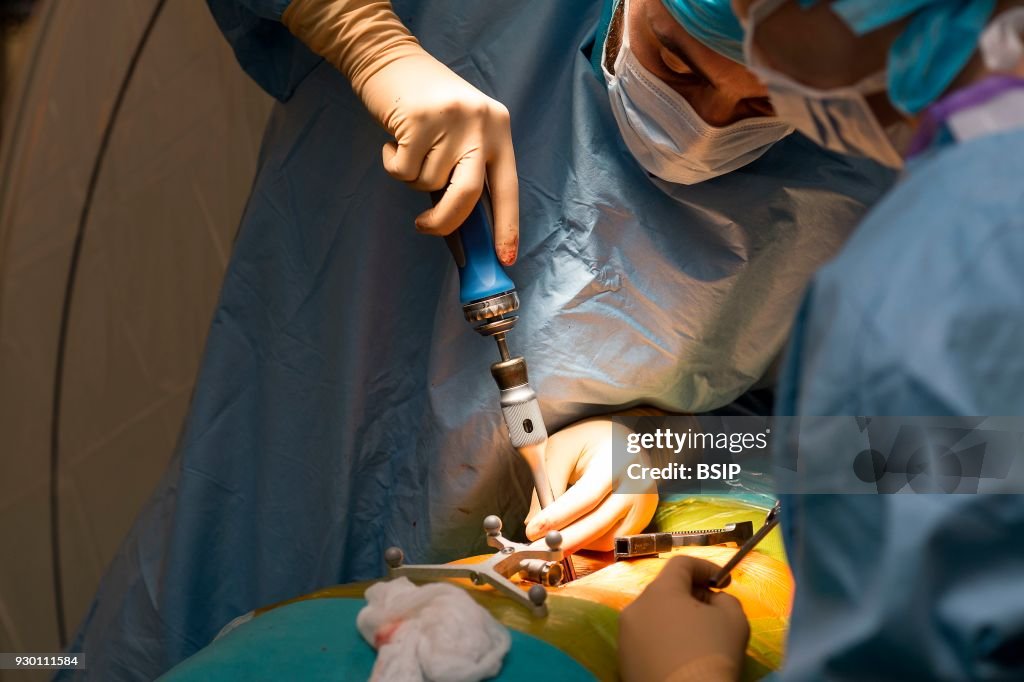 Spine Surgery